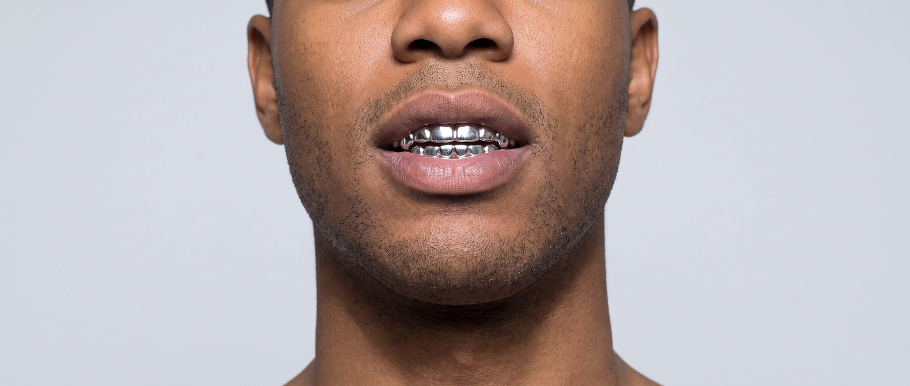 Custom moissanite grillz from Jamilah Jewels